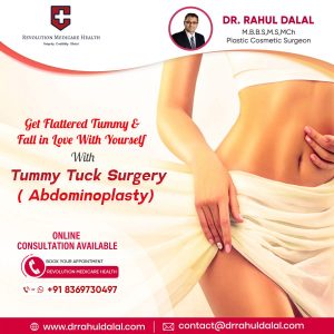 Tummy-Tuck-scaled